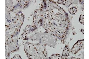 Immunoperoxidase of monoclonal antibody to ARID1B on formalin-fixed paraffin-embedded human placenta. (ARID1B anticorps  (AA 1364-1460))