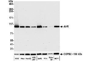 Western Blotting (WB) image for anti-Aryl Hydrocarbon Receptor (AHR) (AA 798-848) antibody (ABIN7453955)