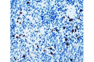 Immunohistochemistry of paraffin-embedded Mouse spleen using SPN Polyclonal Antibody at dilution of 1:100 (40x lens).