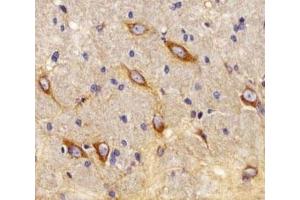 IHC analysis of FFPE rat brain using CB2 antibody at 1:25. (CNR2 anticorps  (AA 329-356))