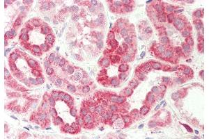 Rabbit Anti-DLST antibody Catalog Number: ARP61476 Formalin Fixed Paraffin Embedded Tissue: Human Kidney Primary antibody Concentration: 1:200 Secondary Antibody: Donkey anti-Rabbit-Cy3 Secondary Antibody Concentration: 1:200 Magnification: 20x Exposure Time: 0.