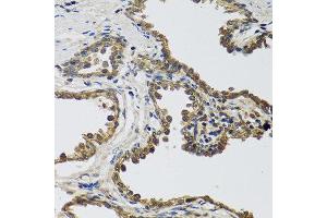 Immunohistochemistry of paraffin-embedded human prostate using IL25 antibody at dilution of 1:100 (40x lens). (IL-25 anticorps)