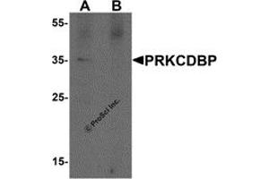 Western Blotting (WB) image for anti-Protein Kinase C, delta Binding Protein (PRKCDBP) antibody (ABIN1077454) (PRKCDBP anticorps)