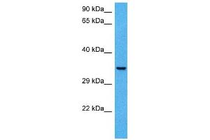 Host:  Mouse  Target Name:  CCNH  Sample Tissue:  Mouse Skeletal Muscle  Antibody Dilution:  1ug/ml (Cyclin H anticorps  (N-Term))