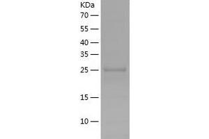 Western Blotting (WB) image for phosphoglycerate Mutase 1 (Brain) (PGAM1) (AA 1-254) protein (His-IF2DI Tag) (ABIN7124421)