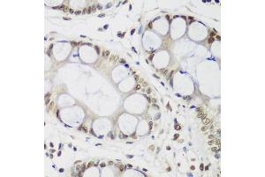 Immunohistochemistry of paraffin-embedded human gastric using CBX3 antibody. (CBX3 anticorps)