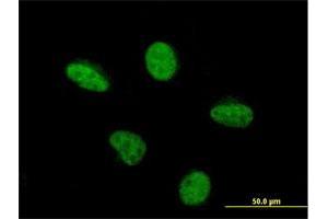 Immunofluorescence of monoclonal antibody to PCAF on HeLa cell.
