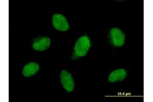 Immunofluorescence of purified MaxPab antibody to FBXO28 on HeLa cell.