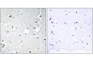 Immunohistochemistry analysis of paraffin-embedded human brain tissue, using JIP1 (Ab-103) Antibody.