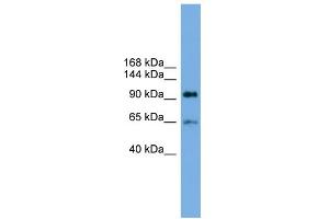 WB Suggested Anti-EXOC6 Antibody Titration: 0.