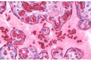 Anti-Hemoglobin antibody IHC staining of human placenta, erythrocytes. (Hemoglobin anticorps)