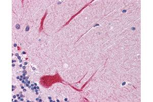 Anti-PTPN11 antibody IHC of human brain, cerebellum. (PTPN11 anticorps  (AA 584-597))