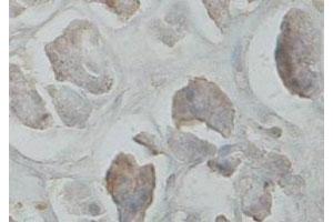 Immunohistochemical staining of formalin-fixed paraffin-embedded human pancreas tissue showing cytoplasmic staining with CARD6 polyclonal antibody  at 1 : 100 dilution. (CARD6 anticorps  (C-Term))