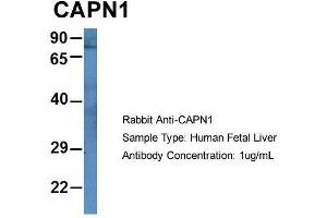 Host: Rabbit  Target Name: CAPN1  Sample Tissue: Human Fetal Liver  Antibody Dilution: 1.