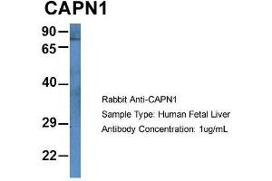 Host: Rabbit  Target Name: CAPN1  Sample Tissue: Human Fetal Liver  Antibody Dilution: 1. (CAPNL1 anticorps  (N-Term))