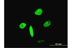 Immunofluorescence of monoclonal antibody to FOXA2 on HeLa cell. (FOXA2 anticorps  (AA 363-457))