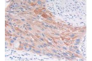 IHC-P analysis of Human Lung Tissue, with DAB staining. (FGFRL1 anticorps  (AA 168-378))