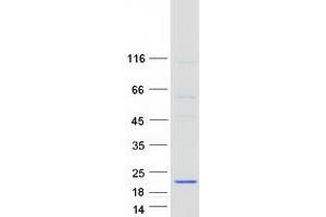 Validation with Western Blot