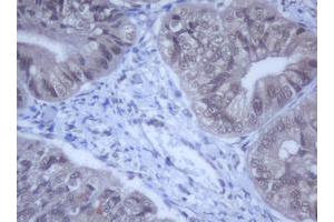 Image no. 13 for anti-DEAD (Asp-Glu-Ala-Asp) Box Polypeptide 59 (DDX59) (AA 1-303) antibody (ABIN1490728) (DDX59 anticorps  (AA 1-303))