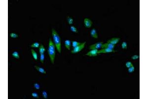 Immunofluorescent analysis of Hela cells using ABIN7154889 at dilution of 1:100 and Alexa Fluor 488-congugated AffiniPure Goat Anti-Rabbit IgG(H+L)