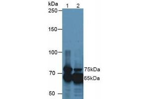 Western blot analysis of (1) Mouse Kidney Tissue and (2) Mouse Eye Tissue. (TGFBI anticorps  (AA 423-632))