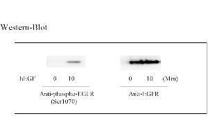 Image no. 4 for Epidermal Growth Factor Receptor (EGFR) ELISA Kit (ABIN625221) (EGFR Kit ELISA)