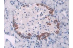 DAB staining on IHC-P; Samples: Rat Pancreas Tissue (UCP1 anticorps  (AA 179-296))
