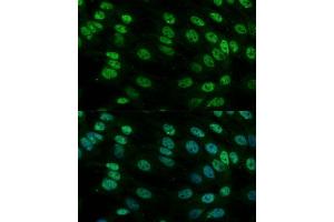 Immunofluorescence analysis of C6 cells using hnRNPM antibody (ABIN6128031, ABIN6141919, ABIN6141920 and ABIN6222681) at dilution of 1:100.