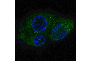 Fluorescent confocal image of HepG2 cells stained with FASN (Center) antibody.