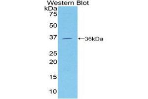 Western Blotting (WB) image for anti-Melanoma Cell Adhesion Molecule (MCAM) (AA 224-464) antibody (ABIN1859777)