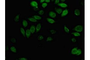 Immunofluorescent analysis of A549 cells using ABIN7143701 at dilution of 1:100 and Alexa Fluor 488-congugated AffiniPure Goat Anti-Rabbit IgG(H+L)