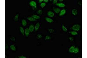 Immunofluorescent analysis of A549 cells using ABIN7143701 at dilution of 1:100 and Alexa Fluor 488-congugated AffiniPure Goat Anti-Rabbit IgG(H+L) (AKR1B1 anticorps  (AA 114-230))