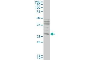 Western Blotting (WB) image for anti-Intraflagellar Transport 57 Homolog (IFT57) (AA 214-313) antibody (ABIN961309) (IFT57 anticorps  (AA 214-313))