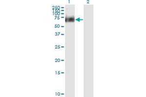 Western Blot analysis of RIPK2 expression in transfected 293T cell line by RIPK2 monoclonal antibody (M02), clone 6F7.