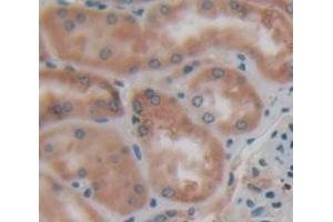 IHC-P analysis of Human Tissue, with DAB staining. (Fascin anticorps  (AA 277-396))