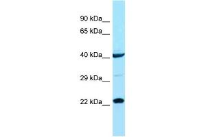 Host: Rabbit Target Name: ASCL1 Sample Type: COLO205 Whole cell lysates Antibody Dilution: 1. (ASCL1 anticorps  (N-Term))