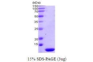Figure annotation denotes ug of protein loaded and % gel used. (Thioredoxin 2 (TXN2) (AA 60-166) Peptide)