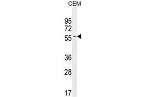 INHBA Antibody (N-term) western blot analysis in CEM cell line lysates (35µg/lane).