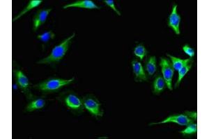 Immunofluorescent analysis of Hela cells using ABIN7164313 at dilution of 1:100 and Alexa Fluor 488-congugated AffiniPure Goat Anti-Rabbit IgG(H+L)
