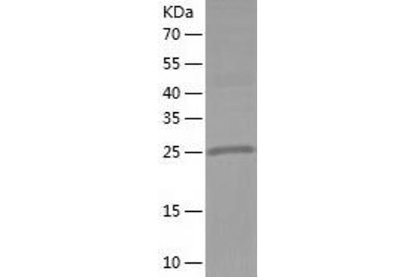 HSD17B8 Protein (AA 1-261) (His tag)