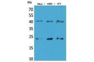 Western Blotting (WB) image for anti-Transmembrane Protein 173 (TMEM173) (C-Term) antibody (ABIN3187979) (STING/TMEM173 anticorps  (C-Term))
