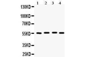 Western Blotting (WB) image for anti-Fascin (FSCN1) (AA 42-73), (N-Term) antibody (ABIN3042407) (Fascin anticorps  (N-Term))