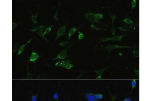 Immunofluorescence analysis of C6 cells using HSP90AA1 Polyclonal Antibody at dilution of 1:100.