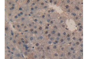 Detection of CASP3 in Human Liver Tissue using Polyclonal Antibody to Caspase 3 (CASP3)