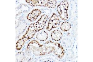 Immunohistochemistry of paraffin-embedded rat kidney using [KO Validated] LDL Receptor (LDLR) Rabbit pAb (ABIN7268296) at dilution of 1:50 (40x lens).
