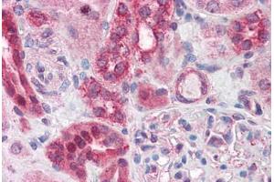 Human Kidney: Formalin-Fixed, Paraffin-Embedded (FFPE) (ABCD4 anticorps  (AA 136-149))