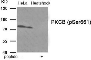 Western blot analysis of extracts from HeLa cells treated with Heatshock using Phospho-PKCB (Ser661) antibody. (PKC beta anticorps  (pSer661))