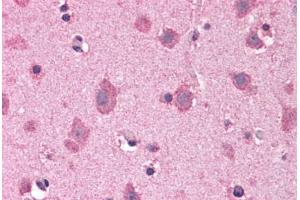 Human Brain, Cortex: Formalin-Fixed, Paraffin-Embedded (FFPE)