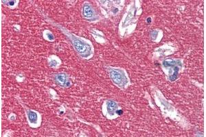 Anti-CADM2 antibody  ABIN1048369 IHC staining of human brain, cortex.