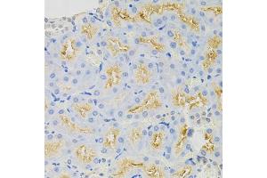 Immunohistochemistry of paraffin-embedded rat kidney using SYK Antibody (ABIN5971150) at dilution of 1/100 (40x lens). (SYK anticorps)